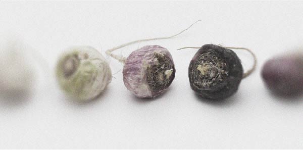 De nouvelles recommandations ont émergé pour traiter la dysfonction érectile