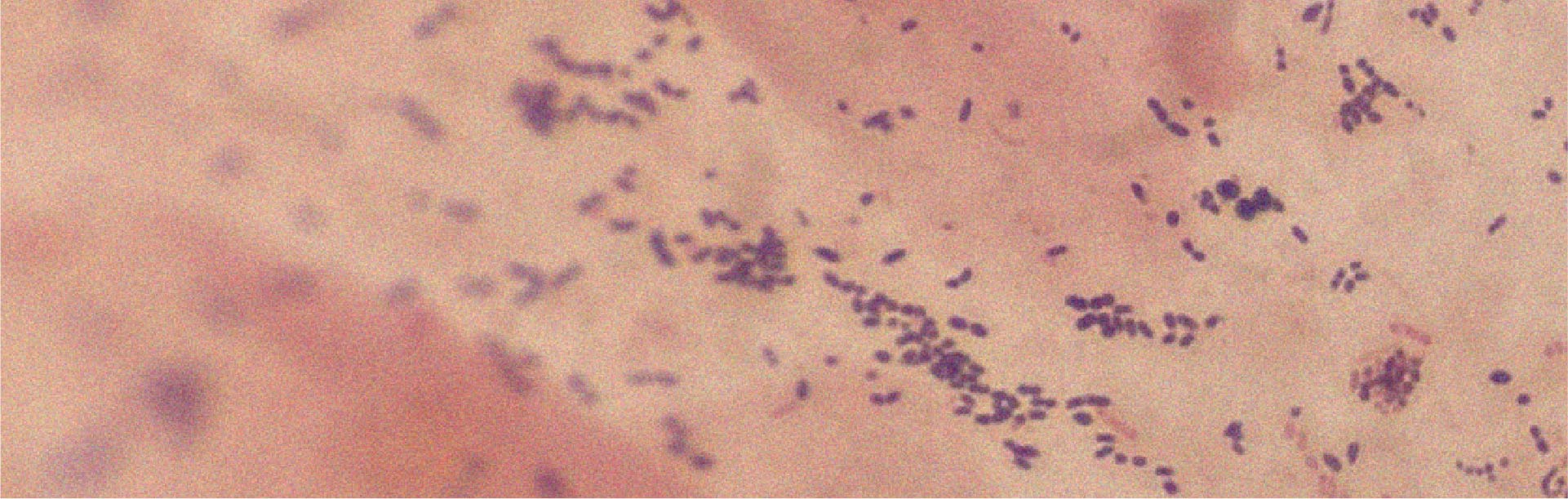 Everything you need to know about Lactobacillus acidophilus