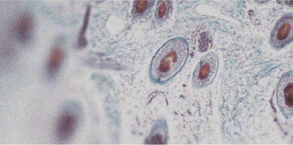 Op welke manieren kan vitamine A goed zijn voor de huid?